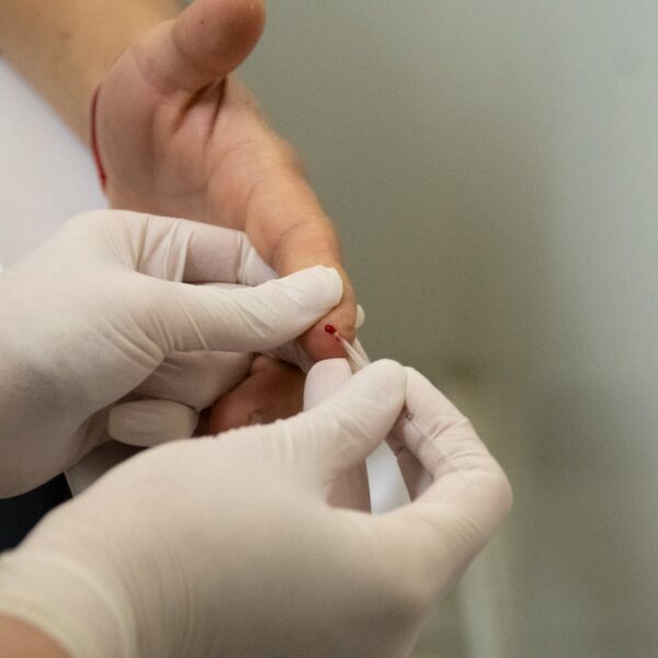 Más de 100 personas ya accedieron al dispositivo municipal de prevención combinada de VIH e ITS